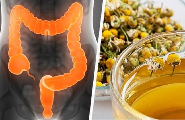 علاج التهاب القولون في المنزل